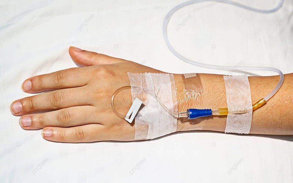 IV Cannulation